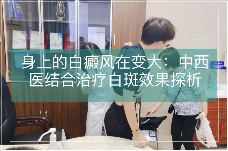 身上的白癜风在变大：中西医结合治疗白斑效果探析