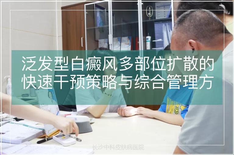 泛发型白癜风多部位扩散的快速干预策略与综合管理方案
