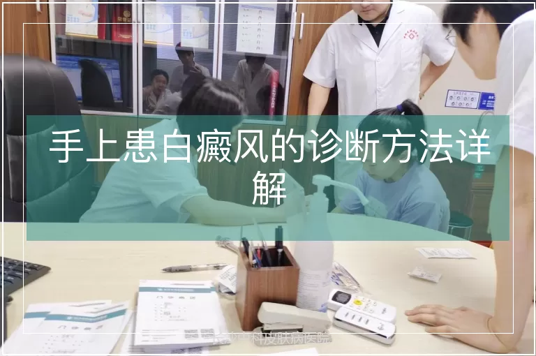 手上患白癜风的诊断方法详解