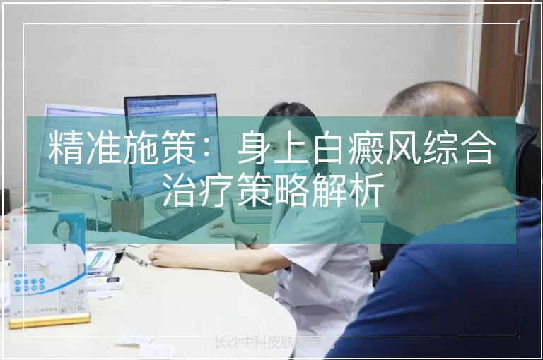 精准施策：身上白癜风综合治疗策略解析