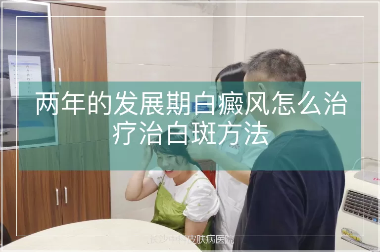 两年的发展期白癜风怎么治疗治白斑方法