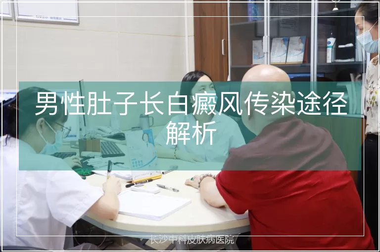 男性肚子长白癜风传染途径解析