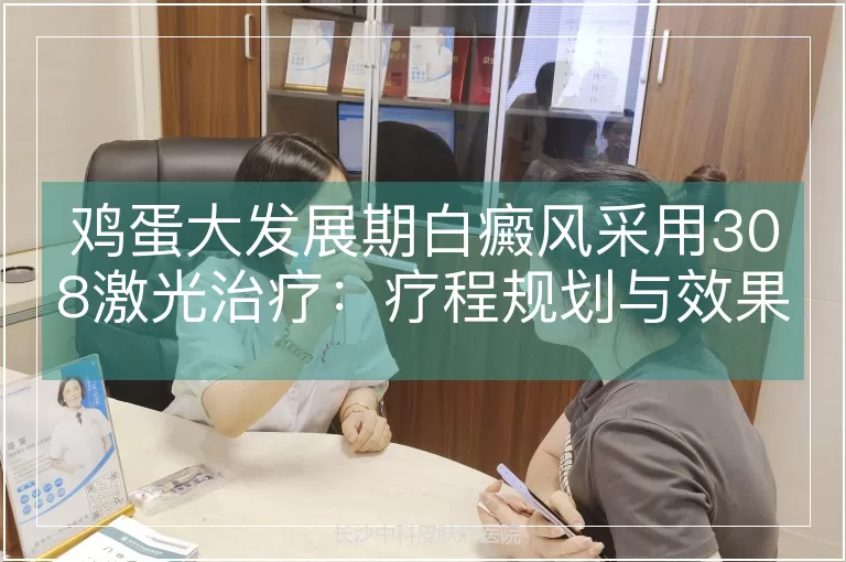 鸡蛋大发展期白癜风采用308激光治疗：疗程规划与效果评估