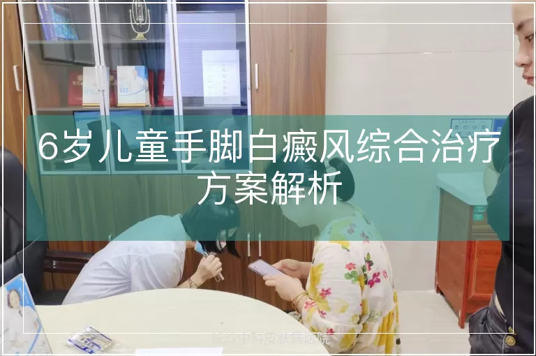 6岁儿童手脚白癜风综合治疗方案解析