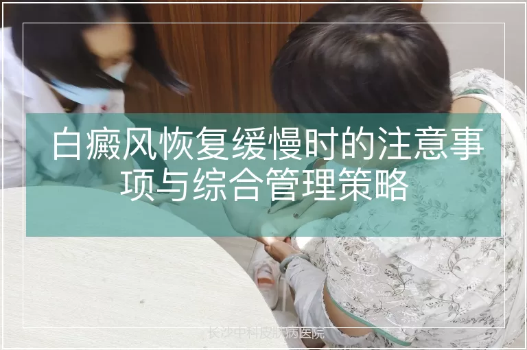 白癜风恢复缓慢时的注意事项与综合管理策略