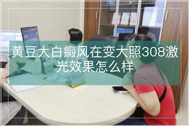 黄豆大白癜风在变大照308激光效果怎么样