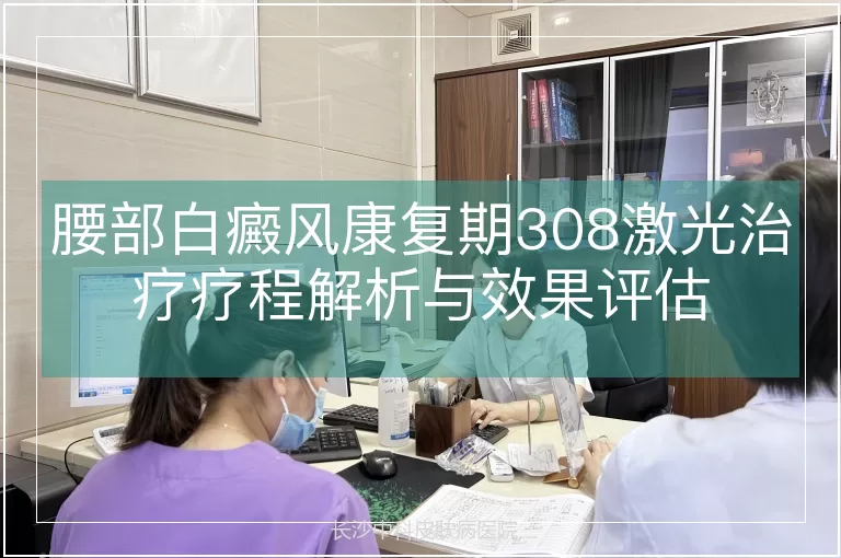 腰部白癜风康复期308激光治疗疗程解析与效果评估