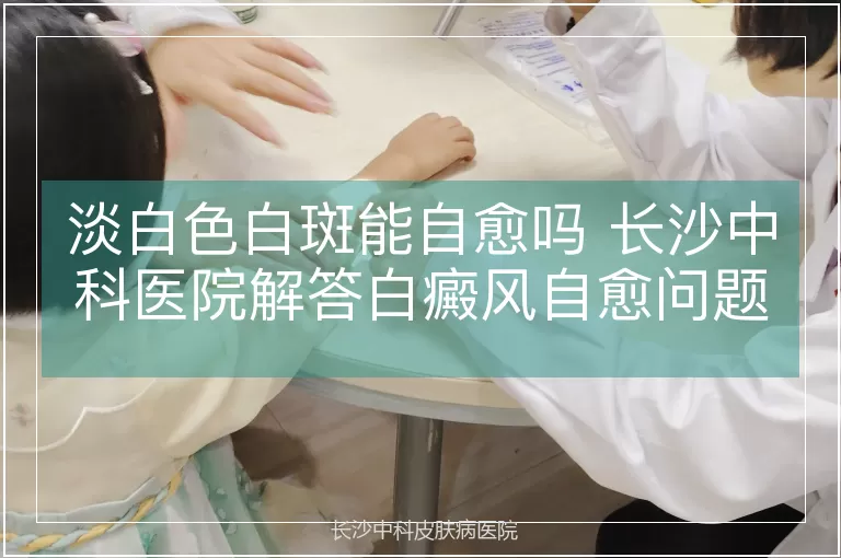 淡白色白斑能自愈吗 长沙中科医院解答白癜风自愈问题