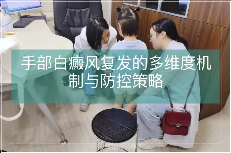 手部白癜风复发的多维度机制与防控策略
