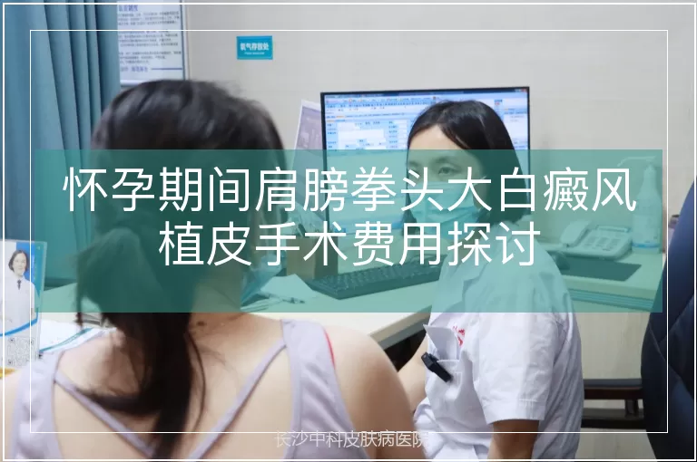 怀孕期间肩膀拳头大白癜风植皮手术费用探讨