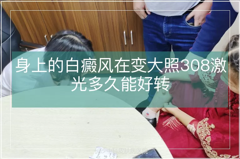 身上的白癜风在变大照308激光多久能好转