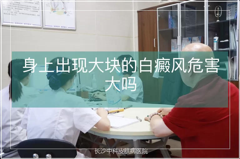 身上出现大块的白癜风危害大吗