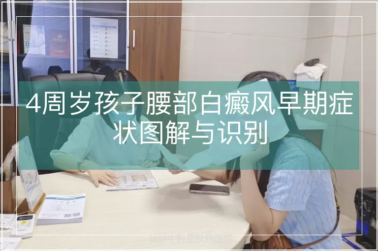 4周岁孩子腰部白癜风早期症状图解与识别