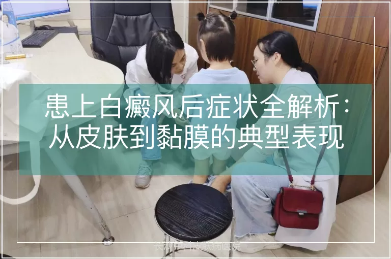 患上白癜风后症状全解析：从皮肤到黏膜的典型表现