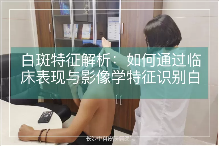 白斑特征解析：如何通过临床表现与影像学特征识别白癜风
