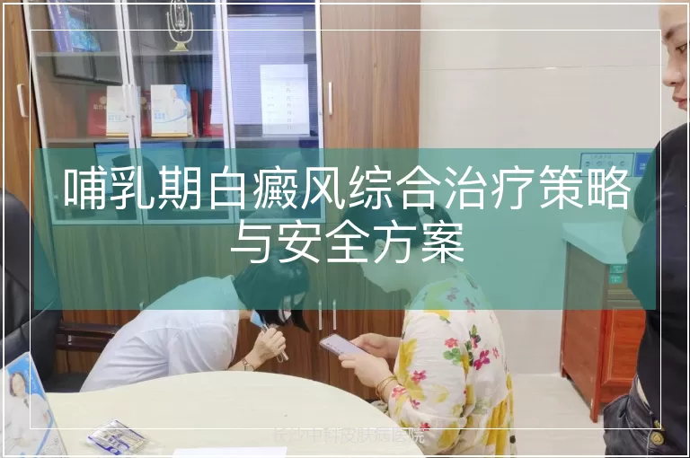 哺乳期白癜风综合治疗策略与安全方案