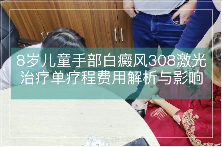 8岁儿童手部白癜风308激光治疗单疗程费用解析与影响因素