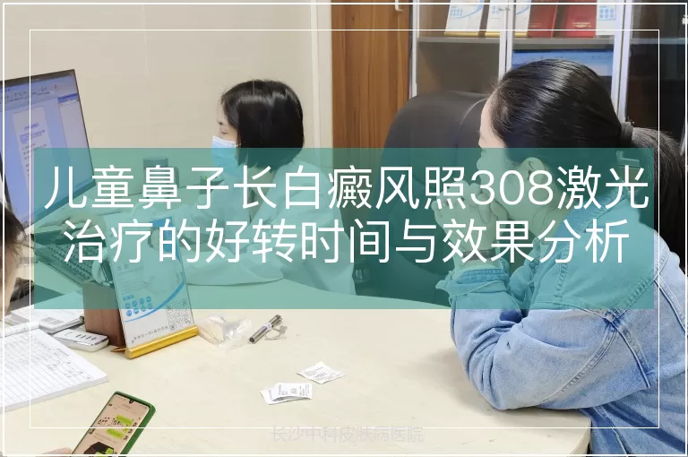 儿童鼻子长白癜风照308激光治疗的好转时间与效果分析