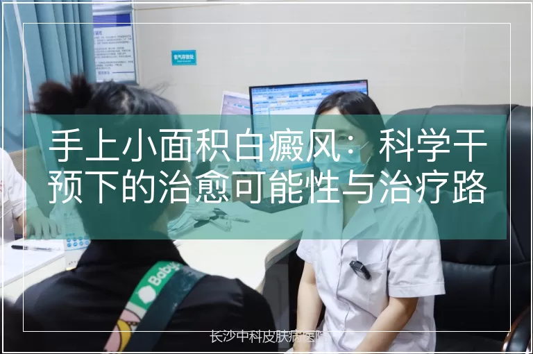 手上小面积白癜风：科学干预下的治愈可能性与治疗路径
