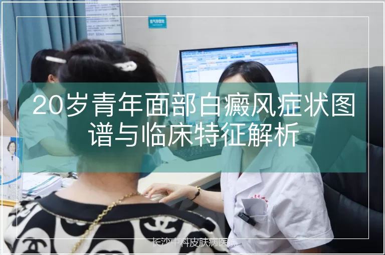 20岁青年面部白癜风症状图谱与临床特征解析