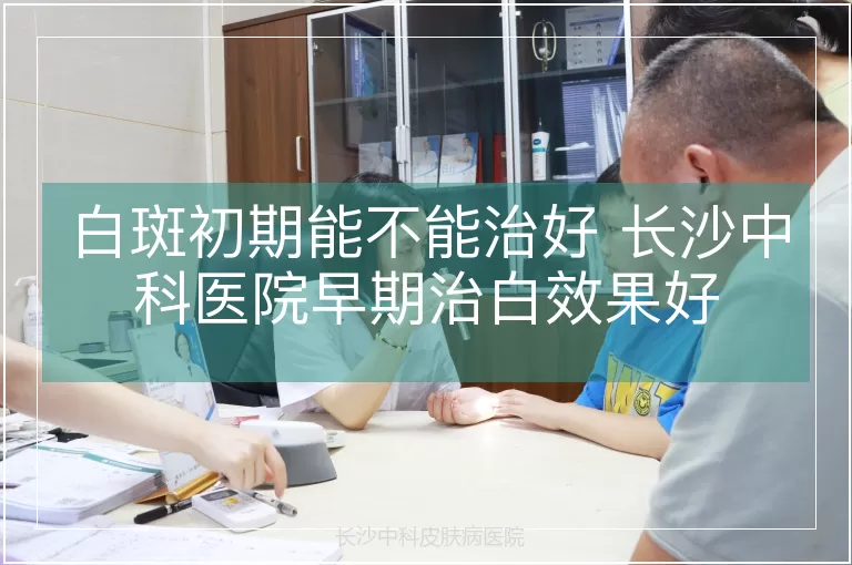 白斑初期能不能治好 长沙中科医院早期治白效果好