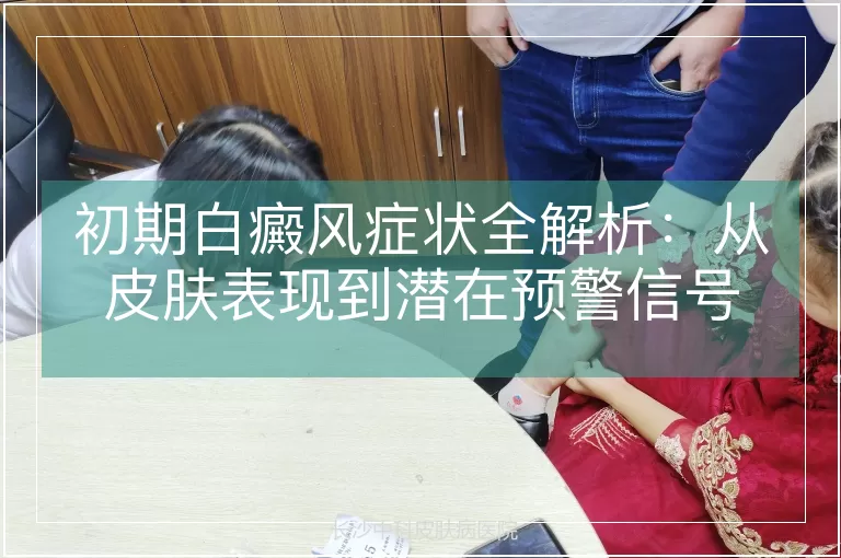 初期白癜风症状全解析：从皮肤表现到潜在预警信号