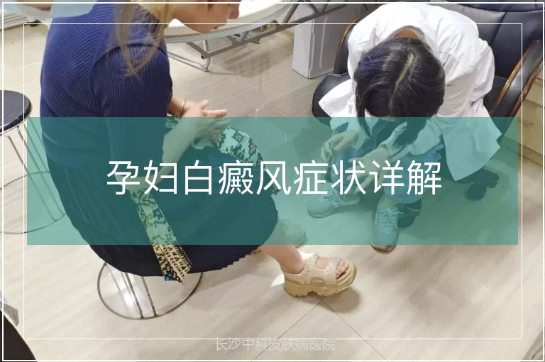 孕妇白癜风症状详解