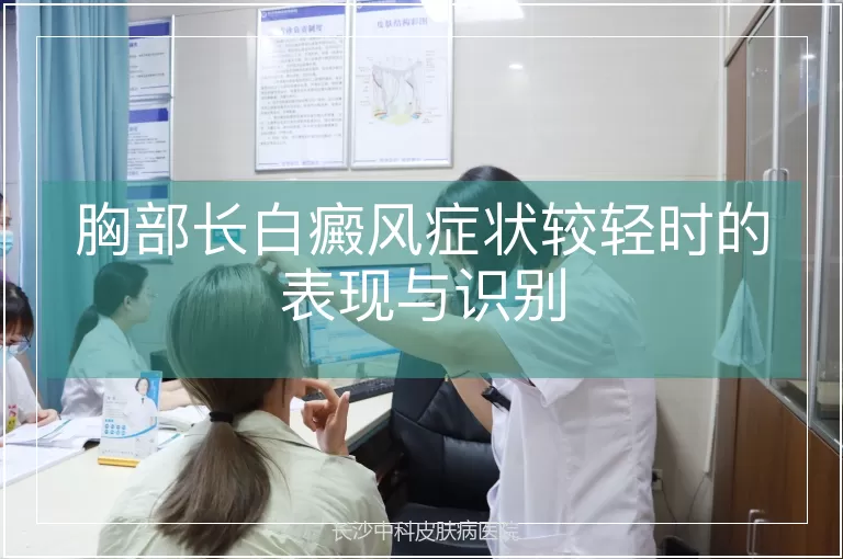 胸部长白癜风症状较轻时的表现与识别
