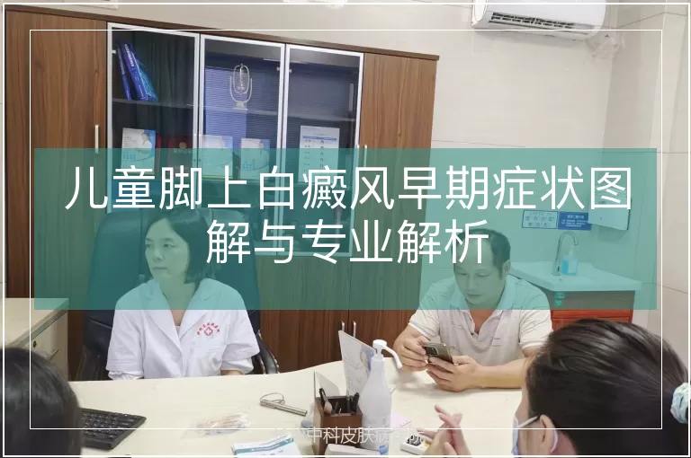 儿童脚上白癜风早期症状图解与专业解析