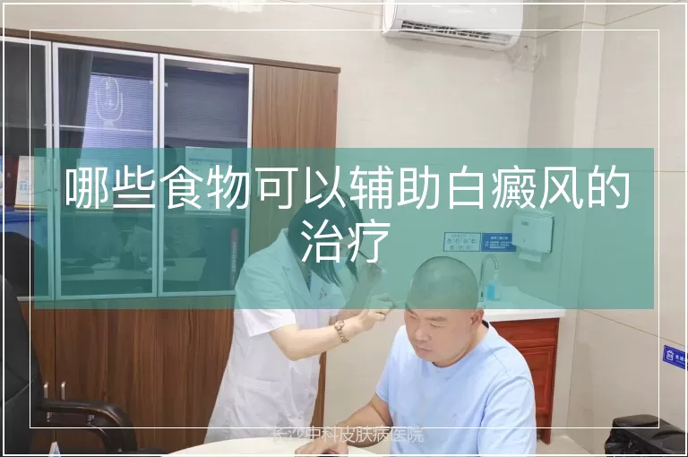 哪些食物可以辅助白癜风的治疗