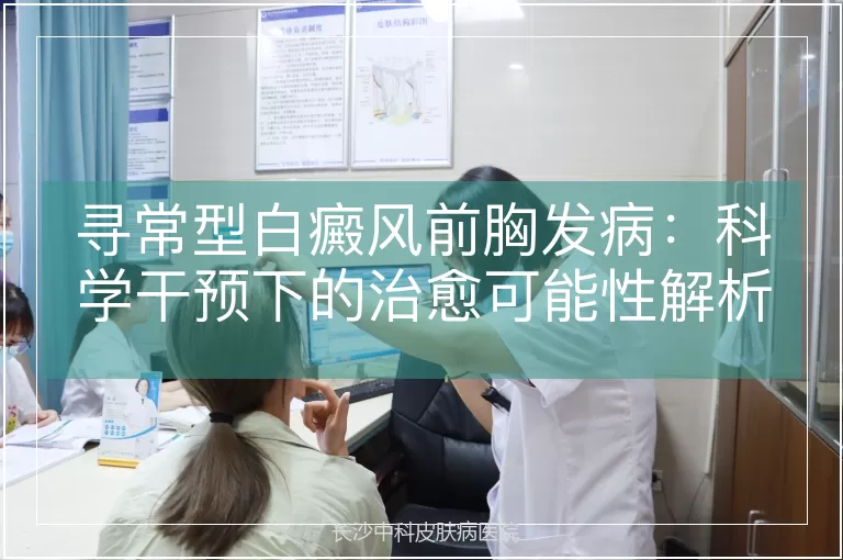 寻常型白癜风前胸发病：科学干预下的治愈可能性解析