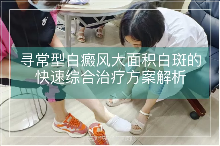 寻常型白癜风大面积白斑的快速综合治疗方案解析
