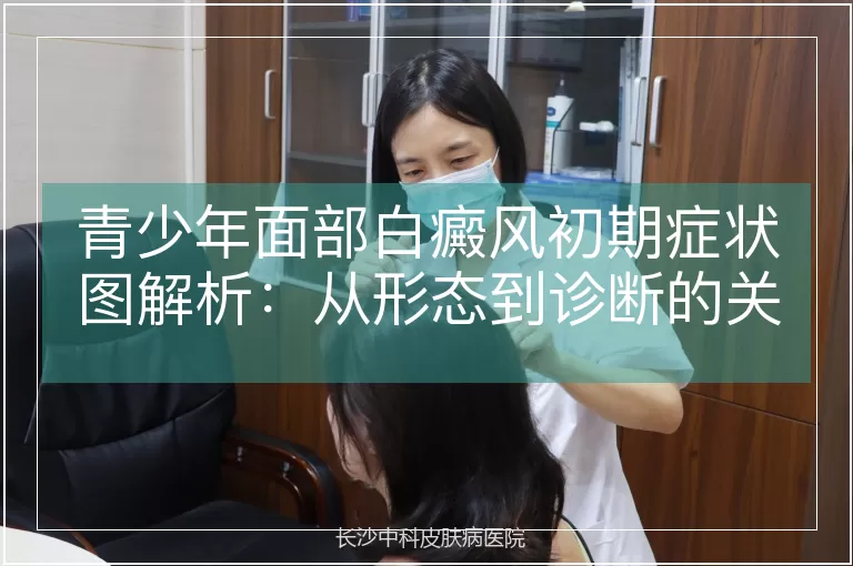 青少年面部白癜风初期症状图解析：从形态到诊断的关键特征