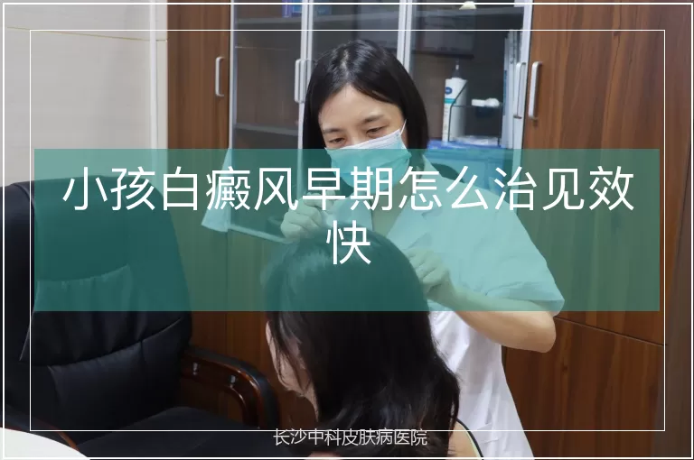 小孩白癜风早期怎么治见效快