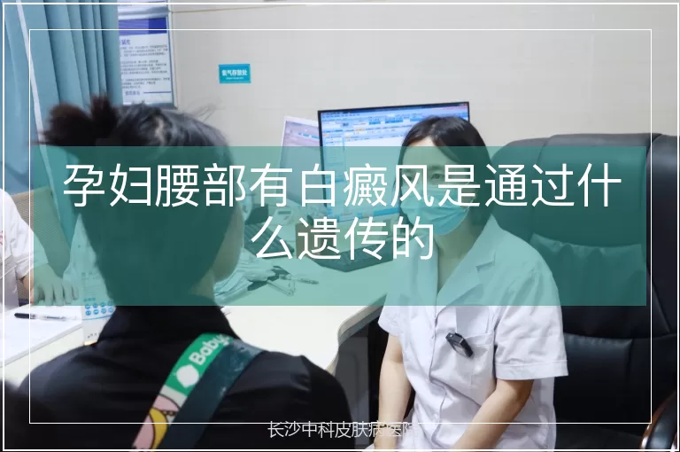 孕妇腰部有白癜风是通过什么遗传的
