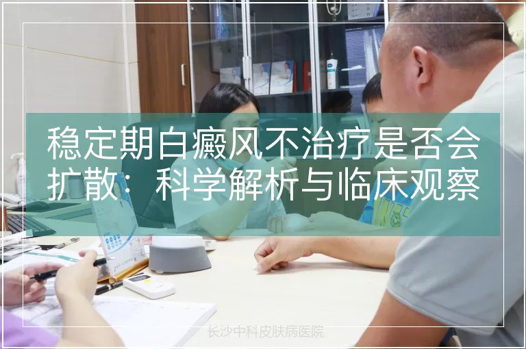 稳定期白癜风不治疗是否会扩散：科学解析与临床观察