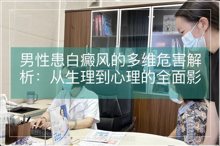 男性患白癜风的多维危害解析：从生理到心理的全面影响