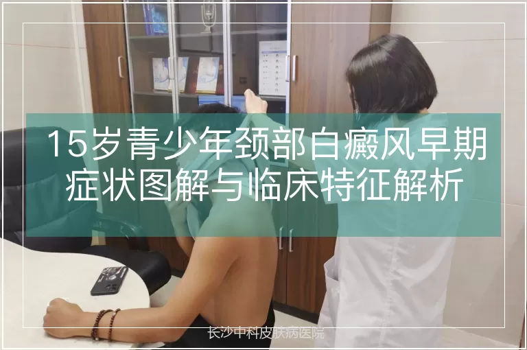 15岁青少年颈部白癜风早期症状图解与临床特征解析