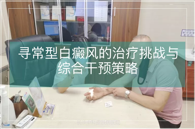 寻常型白癜风的治疗挑战与综合干预策略