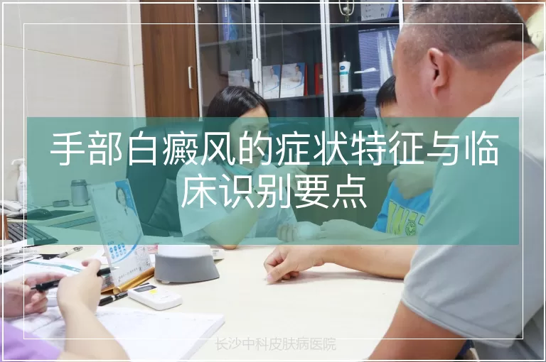 手部白癜风的症状特征与临床识别要点