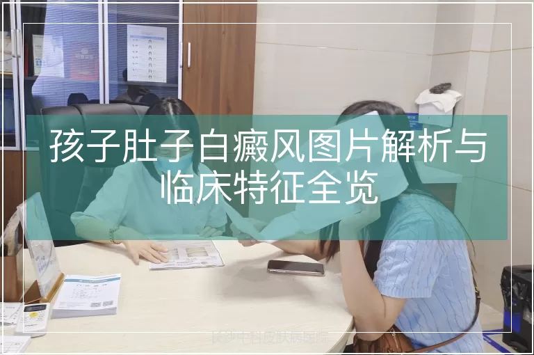 孩子肚子白癜风图片解析与临床特征全览