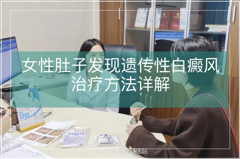 女性肚子发现遗传性白癜风治疗方法详解