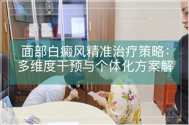 面部白癜风精准治疗策略：多维度干预与个体化方案解析