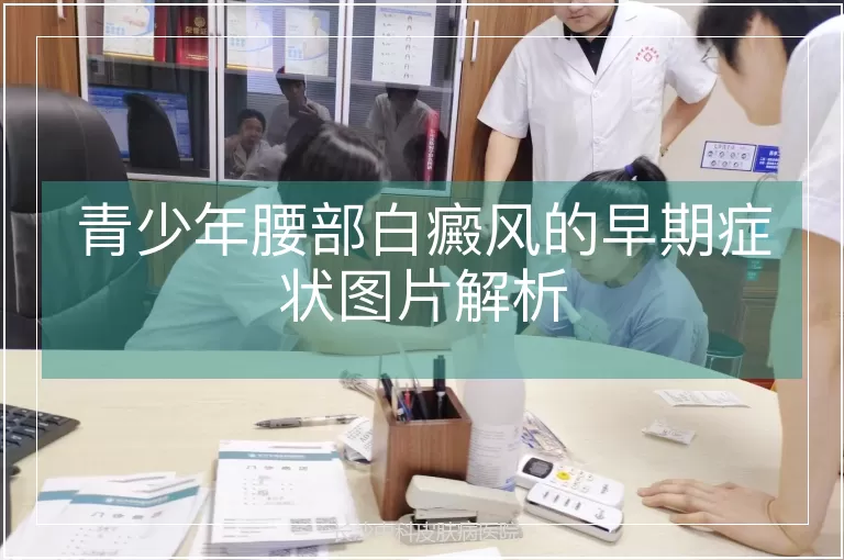 青少年腰部白癜风的早期症状图片解析