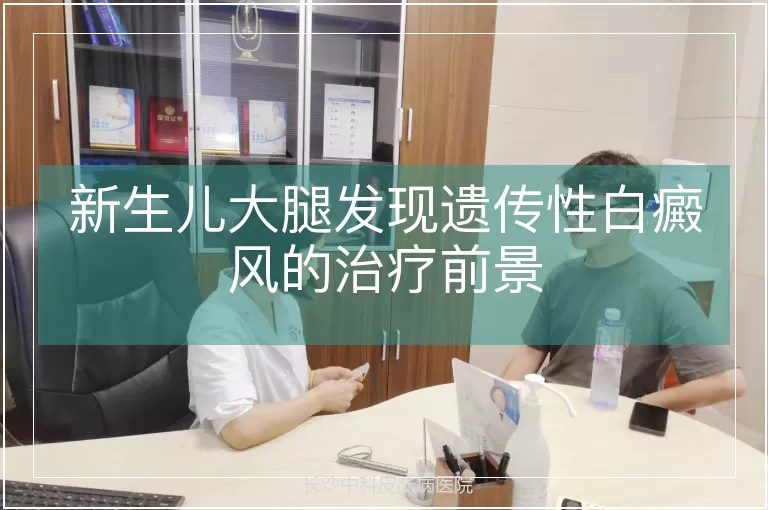 新生儿大腿发现遗传性白癜风的治疗前景