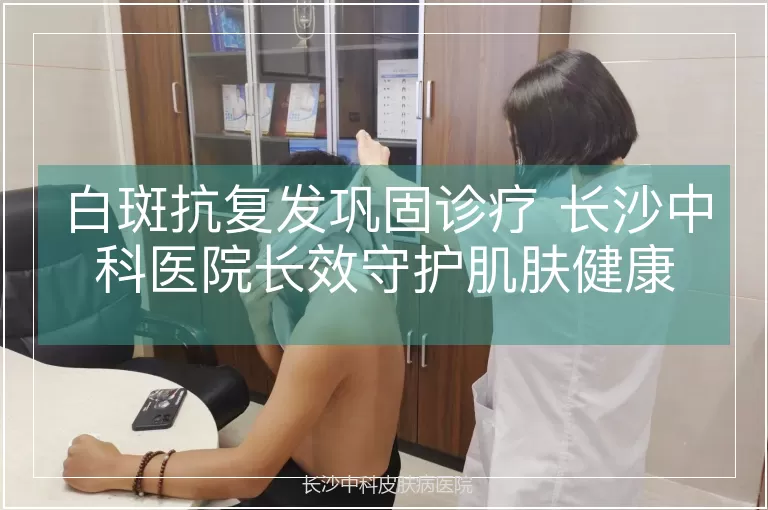 白斑抗复发巩固诊疗 长沙中科医院长效守护肌肤健康