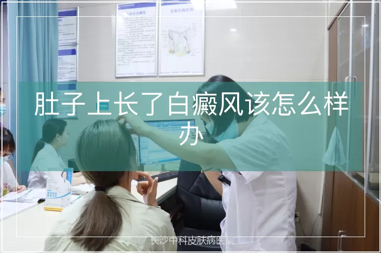 肚子上长了白癜风该怎么样办