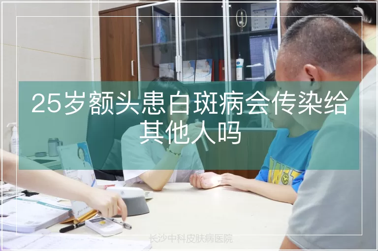 25岁额头患白斑病会传染给其他人吗