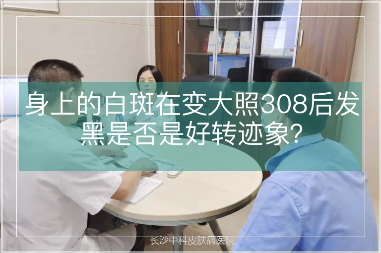 身上的白斑在变大照308后发黑是否是好转迹象？