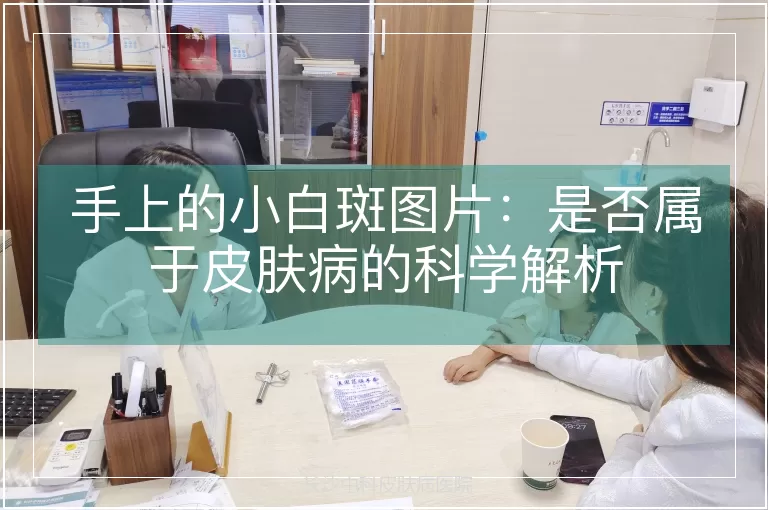 手上的小白斑图片：是否属于皮肤病的科学解析